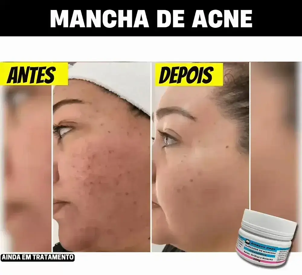 Antes