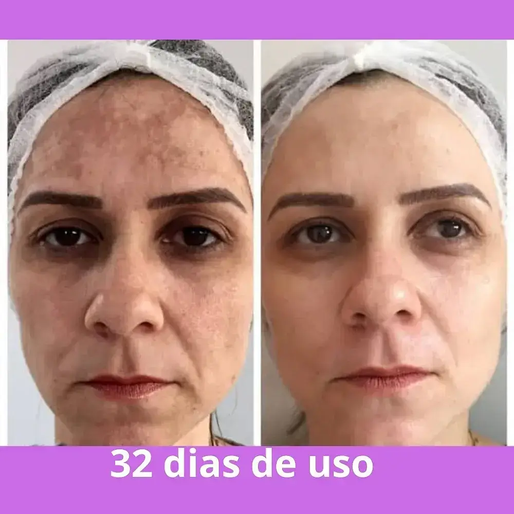 Depois