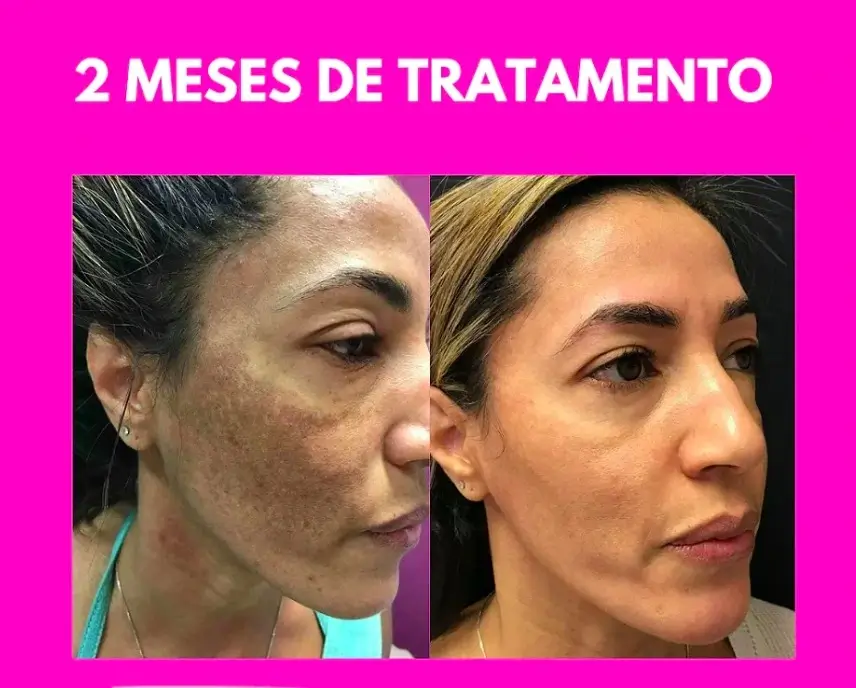 Resultado real