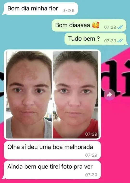 Depoimento 1